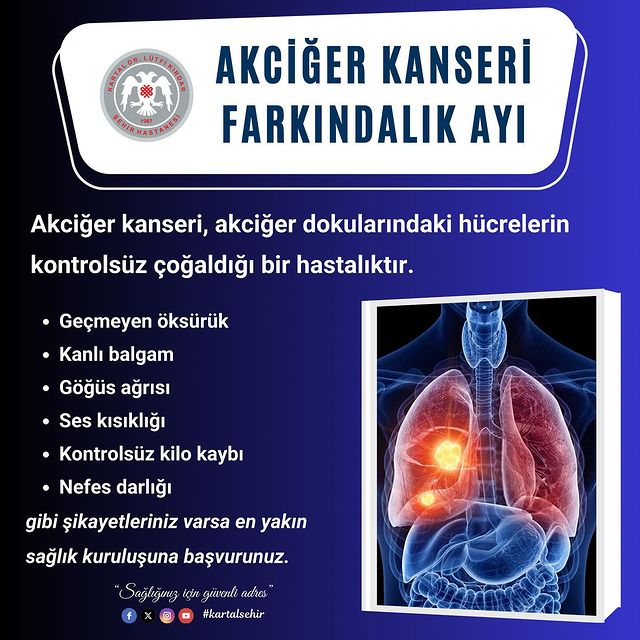 Akciğer Kanseri Farkındalık Ayı: Akciğer Kanseri Hakkında Bilinçlenelim