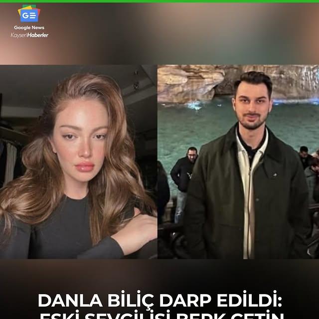 Sosyal Medya Fenomeni Danla Biliç, Eski Sevgilisi Tarafından Darp Edildiğini İddia Etti