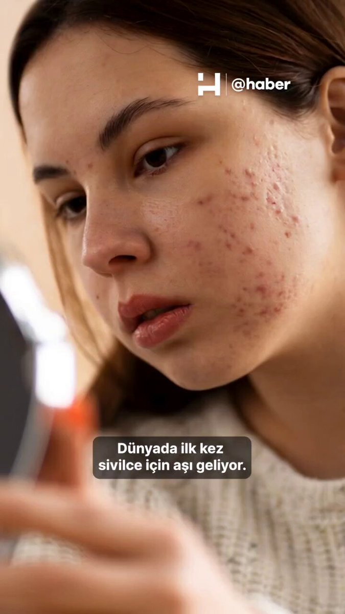 Dünyanın İlk Sivilce Aşısı İçin Klinik Çalışmalar Başladı