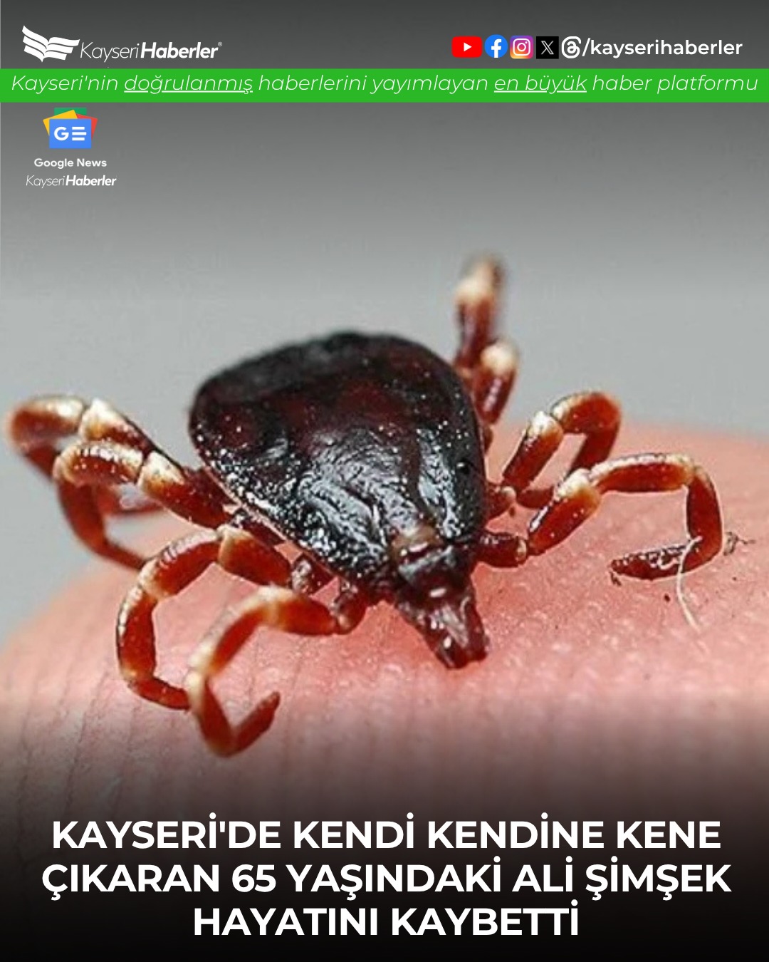 Kayseri'de Kene Çıkarmak Hayatına Mal Oldu