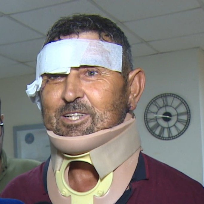 Aslan Saldırısı: Vatandaş Ayaklarından Isırıldı