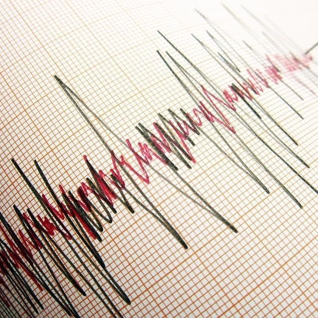 Türkiye, Malatya'da 5.9 Büyüklüğünde Bir Depremle Sarsıldı