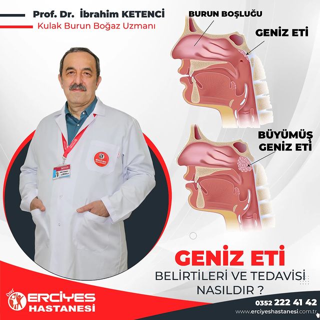 Geniz Eti Büyümesi ve Çocuk Sağlığı Üzerindeki Etkileri