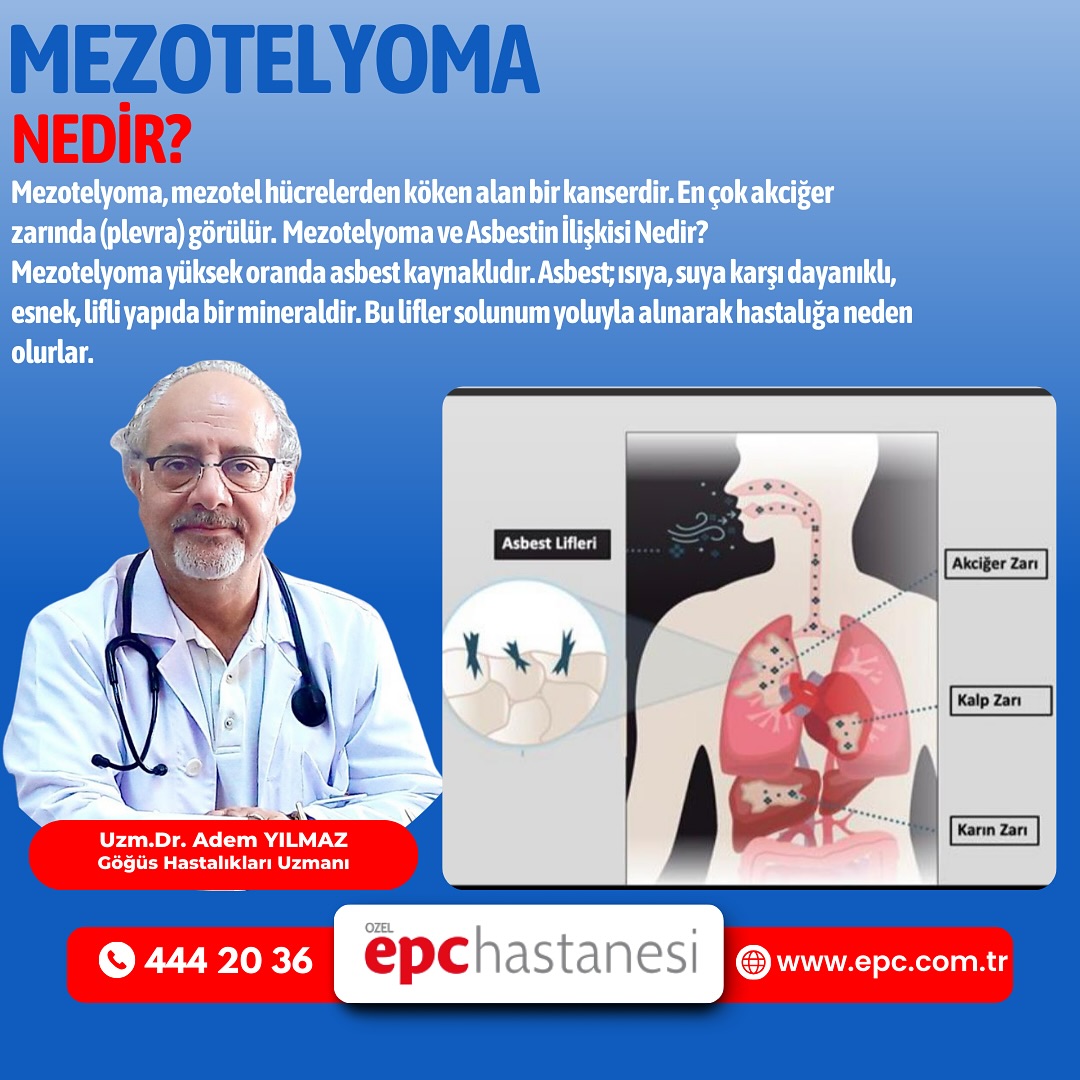 Mezotelyoma: Tehlikeli Bir Kanser Türü