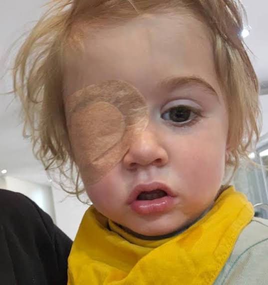 İngiltere'de 2 Yaşındaki Çocuk Herpes Virüsü Nedeniyle Gözünü Kaybetti