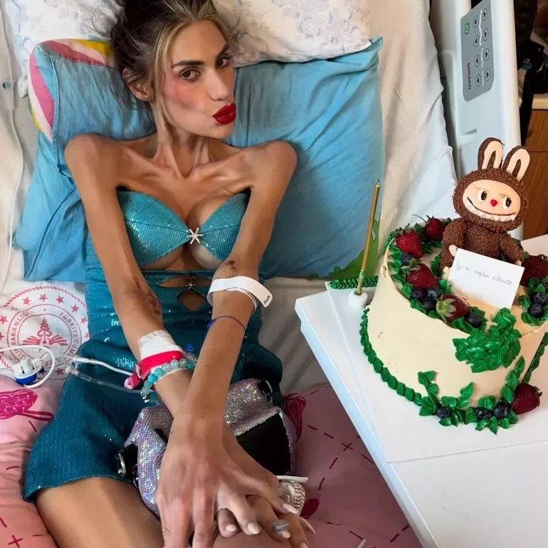 Nihal Candan'ın Kalbi İkinci Kez Durdu: Sağlık Durumu Ciddi