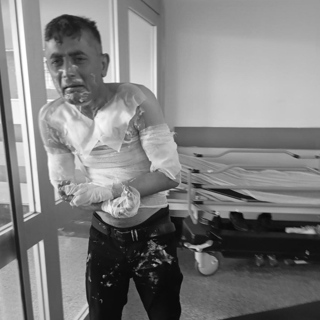 İstanbul'da Dehşet: Engelli Vatandaşa Benzin Dökülerek Ateş Edildi